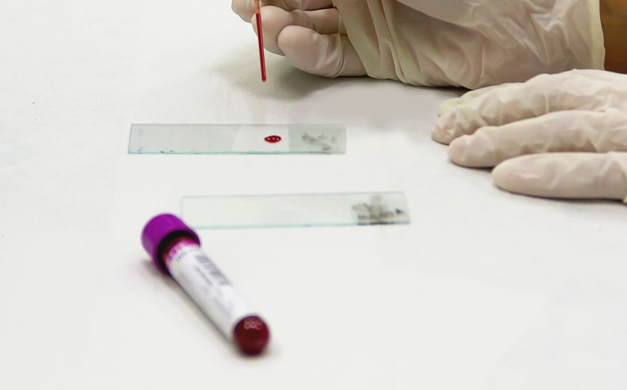 Diabetes at J S Hospital