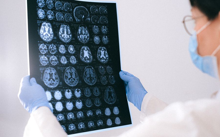 Neurology at J S Hospital